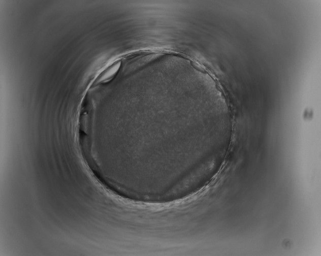 X0000098150002200805011418