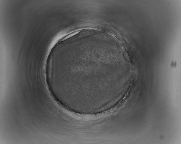 X0000098150006200805011418