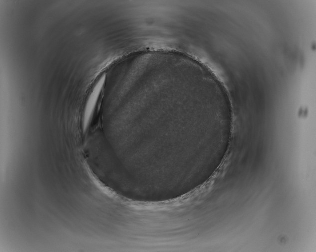 X0000098150009200805011418