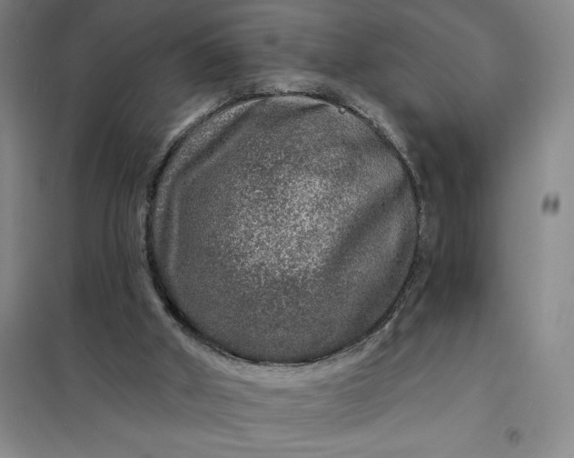 X0000098150010200805011418