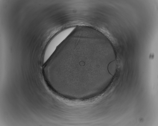 X0000098150014200805011418