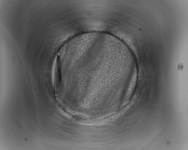 X0000098150017200805011418