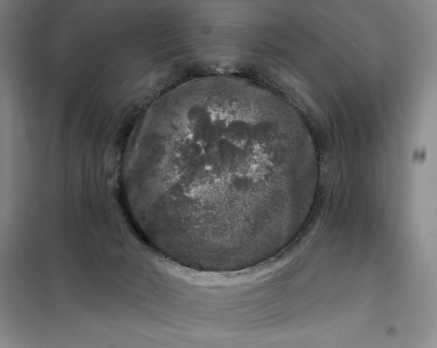 X0000098150030200805011418