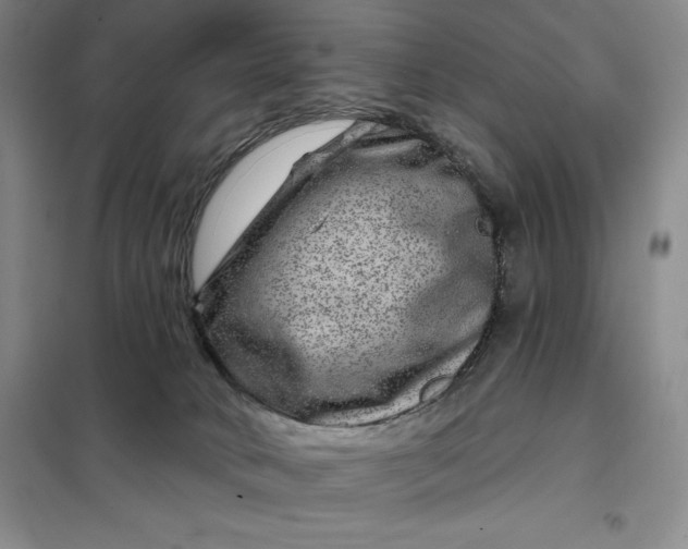 X0000098150034200805011418
