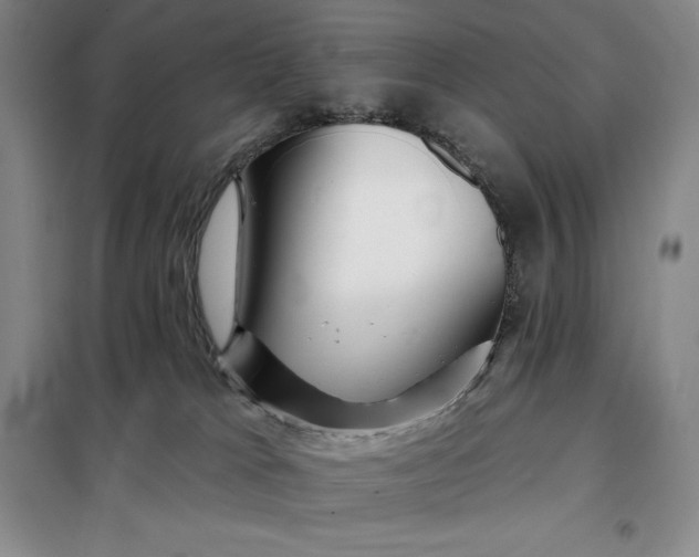 X0000098150037200805011418