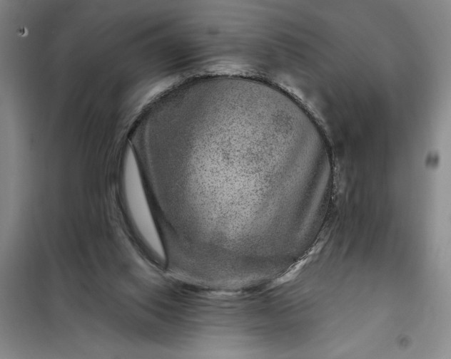 X0000098150062200805011417