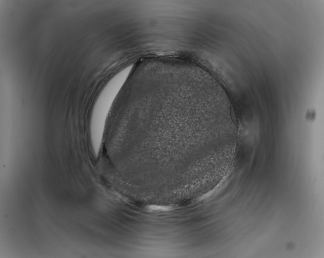 X0000098150170200805011416