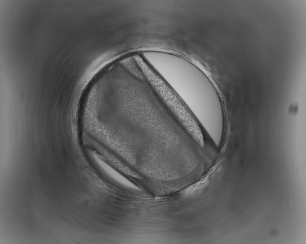 X0000098150199200805011415