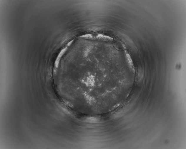 X0000098150236200805011415