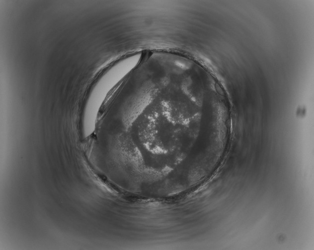 X0000098150249200805011414