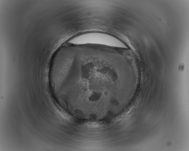 X0000098150299200805011414
