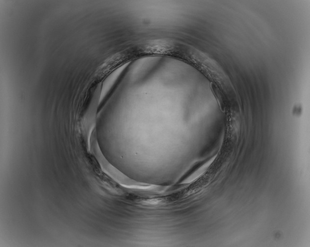 X0000098150312200805011413