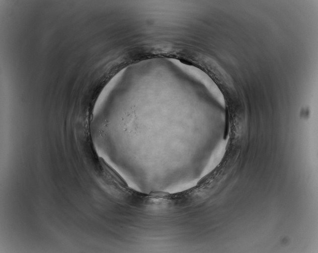 X0000098150376200805011413