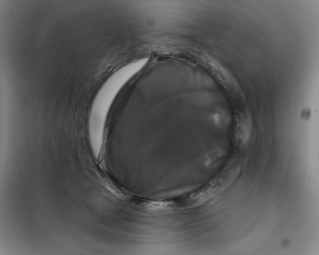 X0000098150465200805011412