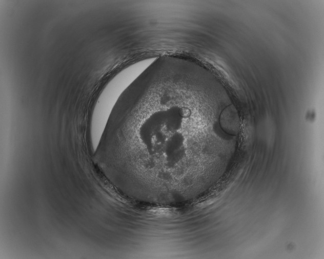 X0000098150499200805011411