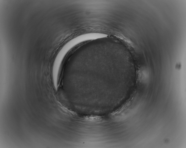 X0000098150517200805011411
