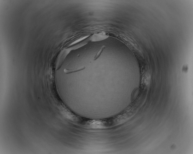 X0000098150518200805011411
