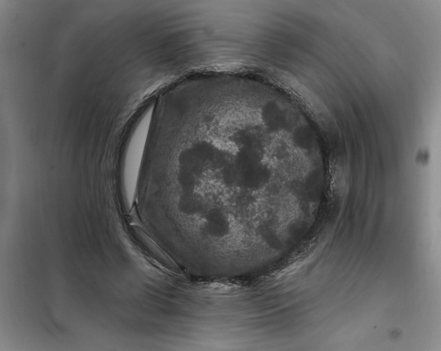 X0000098150542200805011410