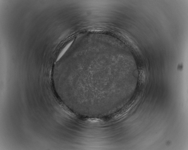 X0000098150557200805011410