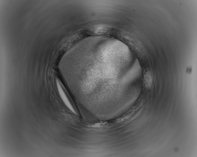X0000098150571200805011410