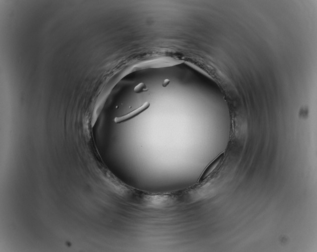 X0000098150575200805011410