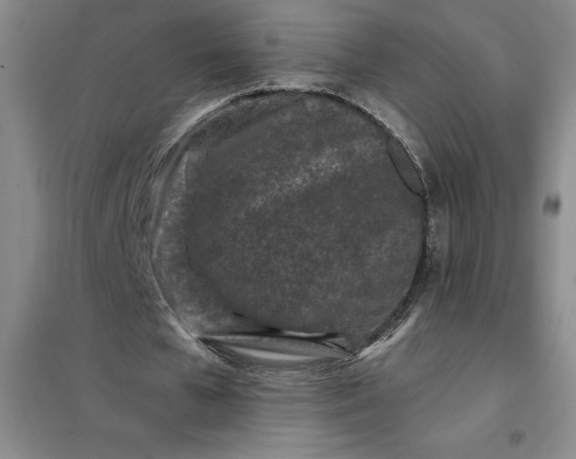 X0000098150577200805011410