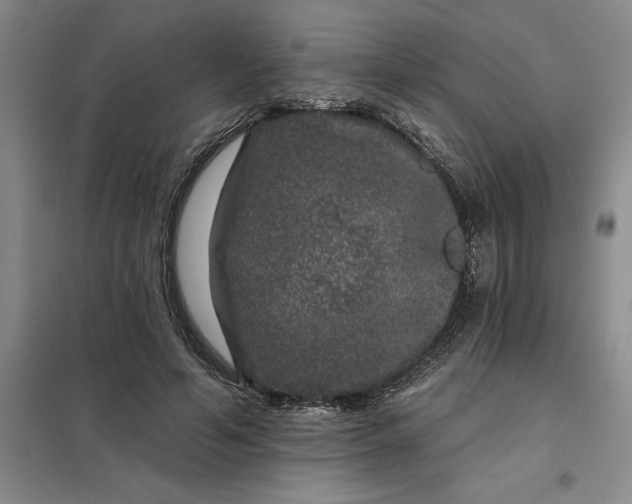 X0000098150594200805011409