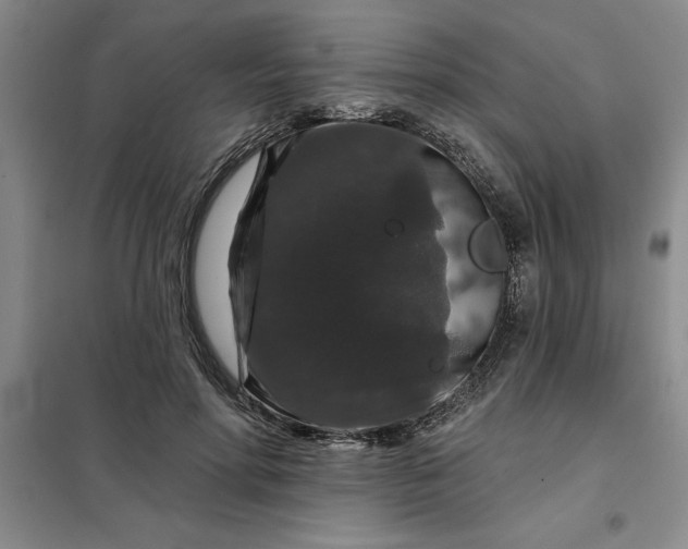 X0000098150598200805011409