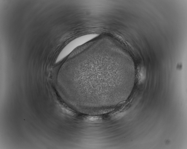 X0000098150619200805011409