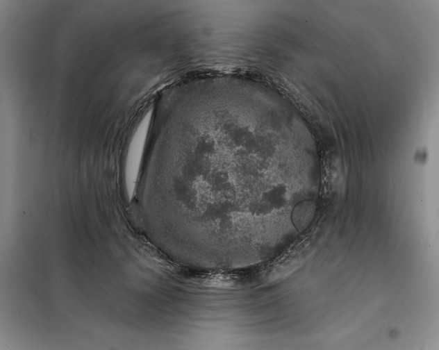 X0000098150656200805011409