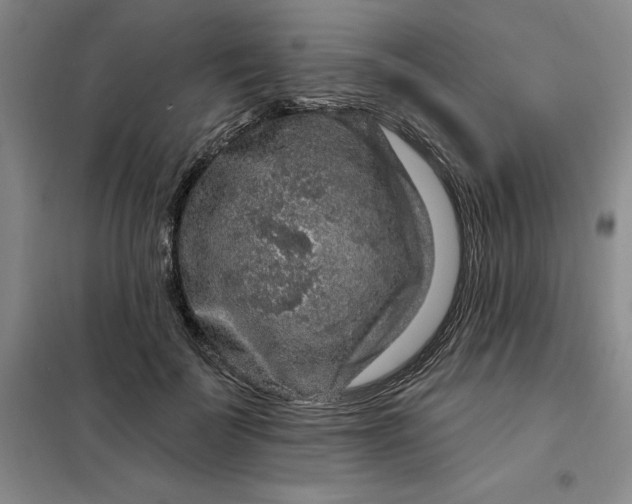 X0000098150699200805011407