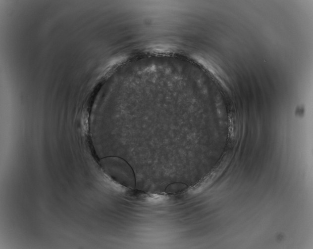 X0000098150718200805011407