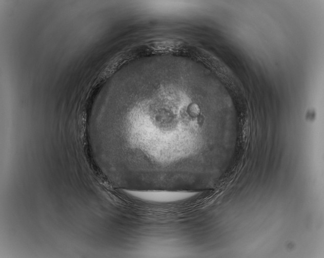 X0000098150737200805011407