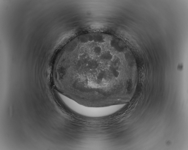 X0000098150742200805011407