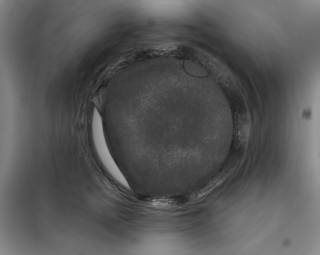 X0000098150758200805011407