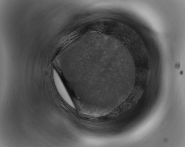 X0000098150766200805011407