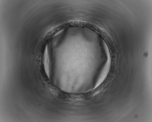 X0000098150870200805011405