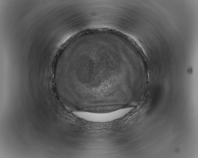X0000098150871200805011405