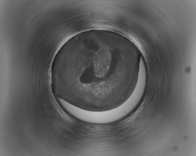 X0000098150891200805011405