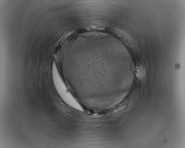 X0000098150915200805011404