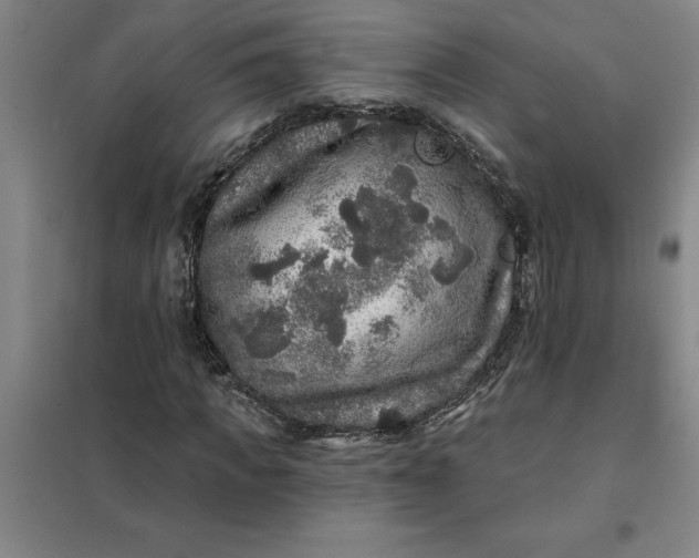 X0000098150917200805011404