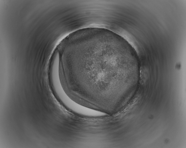 X0000098150972200805011404