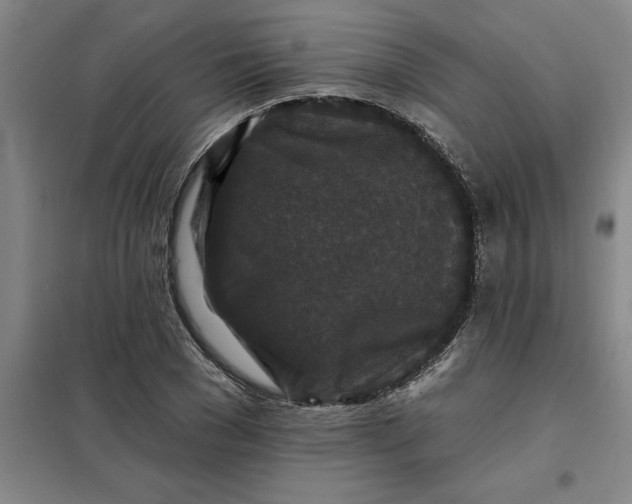 X0000098150977200805011403