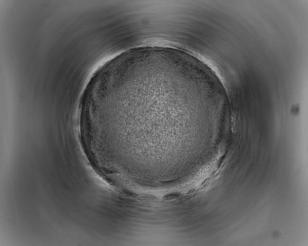 X0000098150987200805011403