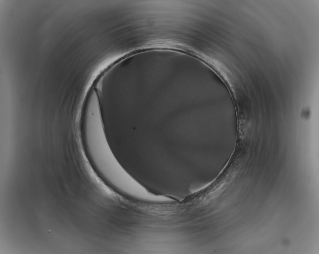 X0000098150995200805011403
