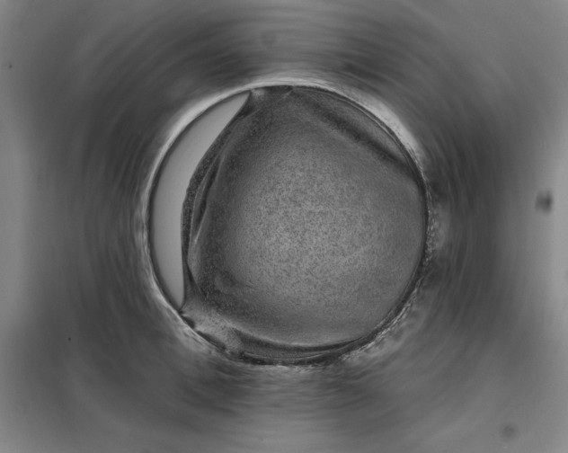 X0000098150996200805011403