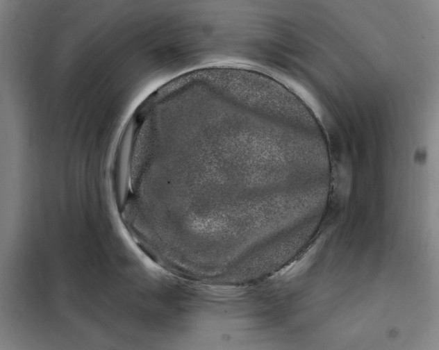 X0000098151007200805011403