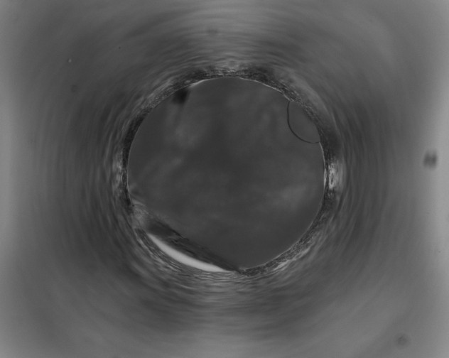 X0000098151011200805011402