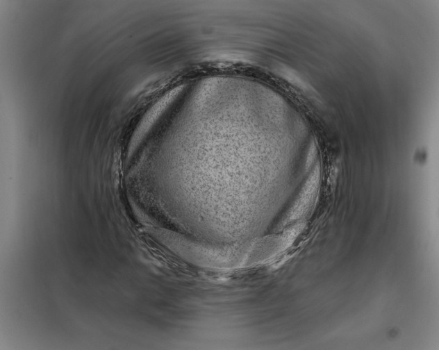 X0000098151014200805011402