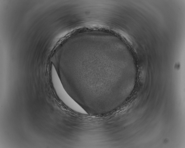 X0000098151016200805011402